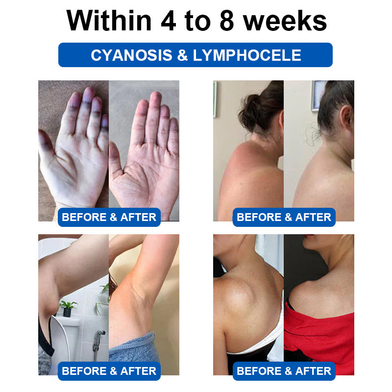✅MHRA Approved | GFOUK™ Ultrasonic Fat Blasting and Detox Wristband (🔥UP TO 70% OFF)
